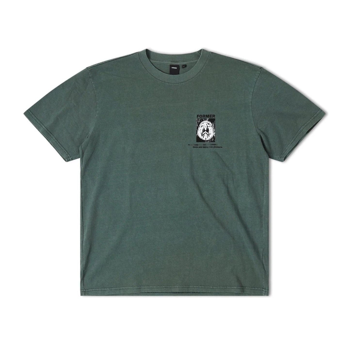 Former Brain Scan Tee Green